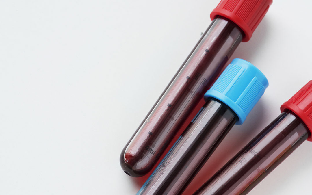 U.S. Supreme Court Ruling on Warrantless Blood Tests Impacts Implied Consent Laws
